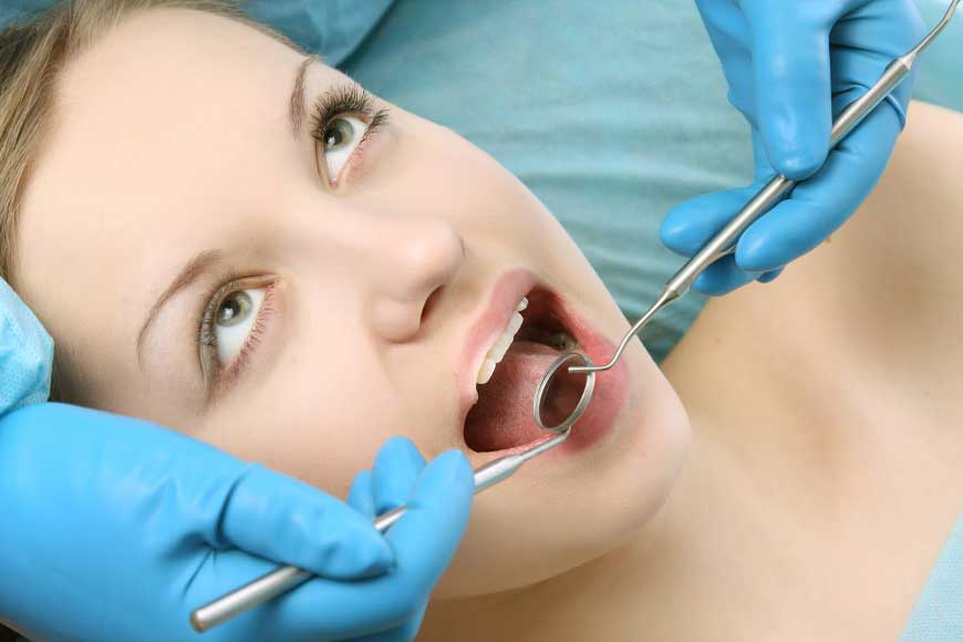 La pulizia dei denti: quanto costa e quanto dura