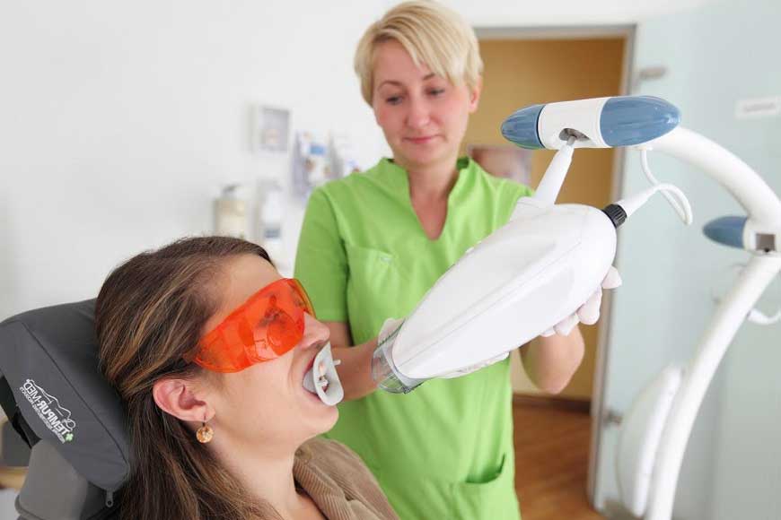 sbiancamento denti professionale